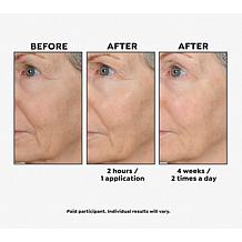Perlier Black Rice 94.5% Pure Hyaluronic Acid Gel