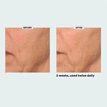 Perlier Black Rice Absolute Youth Face Cream Auto-Ship®