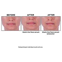 Perlier Black Rice Face Serum & Booster Set