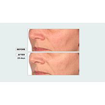 Perlier Black Rice Niacinamide Concentrate Auto-Ship®