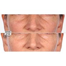 Perlier Black Rice Niacinamide Concentrate Duo