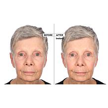 Perlier Black Rice Niacinamide Concentrate Duo