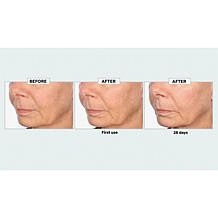 Perlier Black Rice Super Concentrate 9x Hyaluronic Acid Gel Auto-Ship®