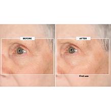 Perlier Black Rice Super Concentrate 9x Hyaluronic Acid Gel