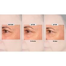 Perlier Black Rice Triple-Size Flash Effect Eye Serum 2-pk Auto-Ship®