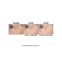 Perlier Black Rice Triple-Size Hyaluronic Acid Gel