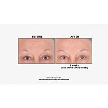 Perlier Bonus Size Royal Elixir Face Mask Auto-Ship®