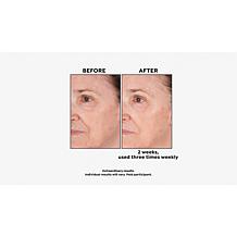 Perlier Bonus Size Royal Elixir Face Mask
