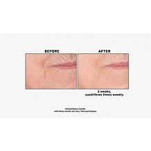 Perlier Honey Royal Jelly Lemon Body Cream and Shower Cream Set