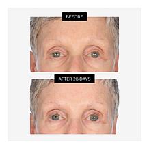 Perlier Jumbo Black Rice Super Concentrate 9x Hyaluronic Acid