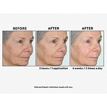 Perlier Megasize Black Rice Hyaluronic Acid Gel
