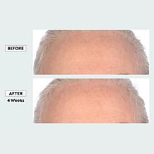 Perlier Royal Elixir Extreme Timecode Serum