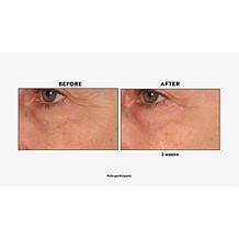 Perlier Royal Elixir Eye Serum Auto-Ship®