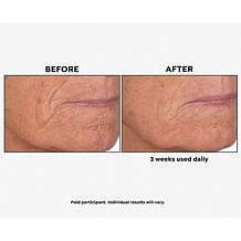 Perlier Royal Elixir Pearls of Youth Alcohol-Free Serum Auto-Ship®