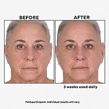 Perlier Supersize Royal Elixir Pearls of Youth Serum Auto-Ship®