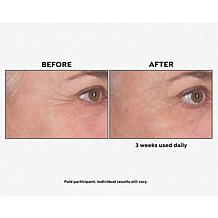 Perlier Supersize Royal Elixir Pearls of Youth Serum Auto-Ship®