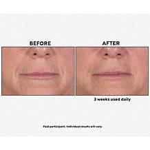 Perlier Supersize Royal Elixir Pearls of Youth Serum