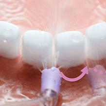 Philips Sonicare 2-pack Quad Stream Water Flosser Nozzle Set