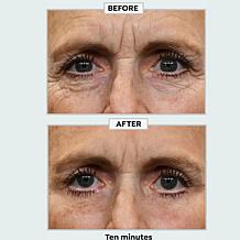 Plexaderm Rapid Reduction Wrinkle Serum 2-pack Auto-Ship®