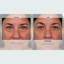 Plexaderm Rapid Reduction Wrinkle Serum 2-pack