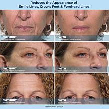 Plexaderm Rapid Reduction Wrinkle Serum and Moisturizer