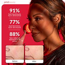 PMD Clean Redvolution SonicGlow™ & Red Light Therapy