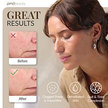 PMD SilkSteam Pro Facial Steamer