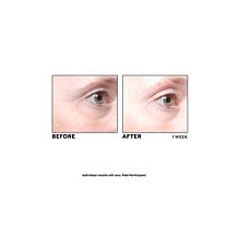 PRAI Ageless Eye Tight Uplift Serum Duo