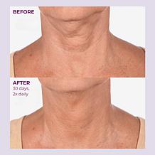 PRAI Beauty Ageless Throat & Decolletage Creme Intensive Gold+ AS