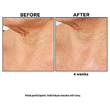 PRAI Beauty Ageless Throat Caviar Overnight Recovery Serum Auto-Ship®