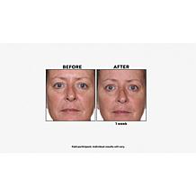 PRAI Beauty Platinum Firm & Lift Creme & Night Creme Auto-Ship®