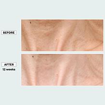 Sharper Image Revel LED Light Therapy Neck & Décolletage Mask