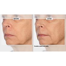 Signature Club A 5 Essentials Cream for Face and Eyes 2-Pack