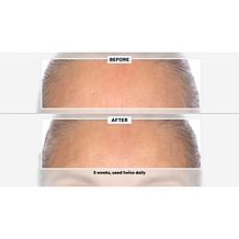 Signature Club A 5 Essentials Cream for Face and Eyes