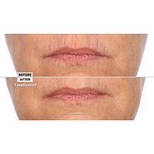 Signature Club A Intensive Lip Fix Cream