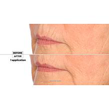 Signature Club A Intensive Lip Fix Cream