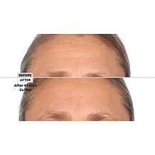 SKINN 3-piece Lab Insider Face Boot Camp Set Auto-Ship®