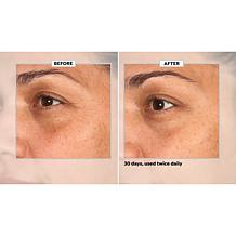 SKINN 30-Day Eye Boot Camp Auto-Ship®