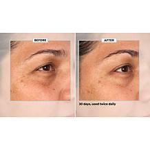 SKINN 30-Day Eye Boot Camp