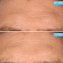 SKINN Age Reset Advanced Night Cream Auto-Ship®