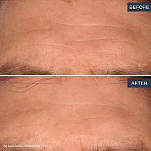 SKINN Age Reset Advanced Night Cream Auto-Ship®