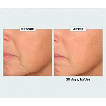 SKINN Age Reset Advanced Night Cream