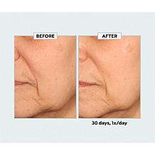 SKINN Age Reset Advanced Night Cream