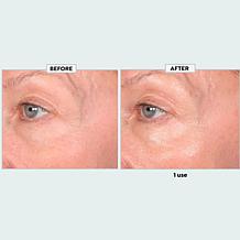 SKINN Age Reset Illuminate Eye Serum- Auto-Ship®