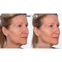 SKINN Age Reset Serum and Headband 2-piece Set