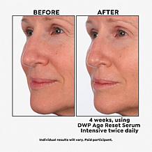 SKINN Age Reset Serum Auto-Ship®