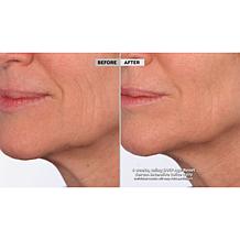 SKINN Age Reset Serum