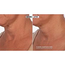 Skinn Cosmetics Neck Amour Defining Serum Auto-Ship®