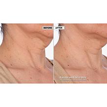 Skinn Cosmetics Neck Amour Defining Serum