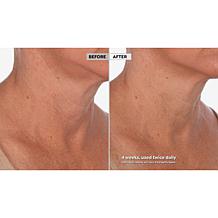 Skinn Cosmetics Neck Amour Redensifying Serum